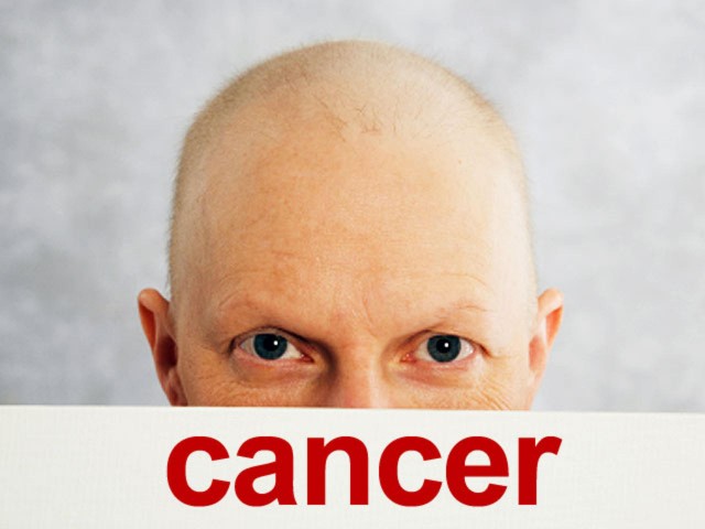Cancer - Ayurvedic view and treatment options