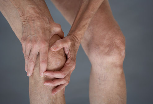 Osteo Arthritis Ayurvedic Herbal Treatment