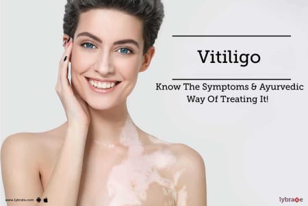 Vitiligo Leucoderma Ayurvedic Herbal Remedies