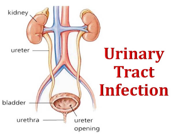 Urinary Tract Infection UTI  Ayurvedic Herbal Treatment